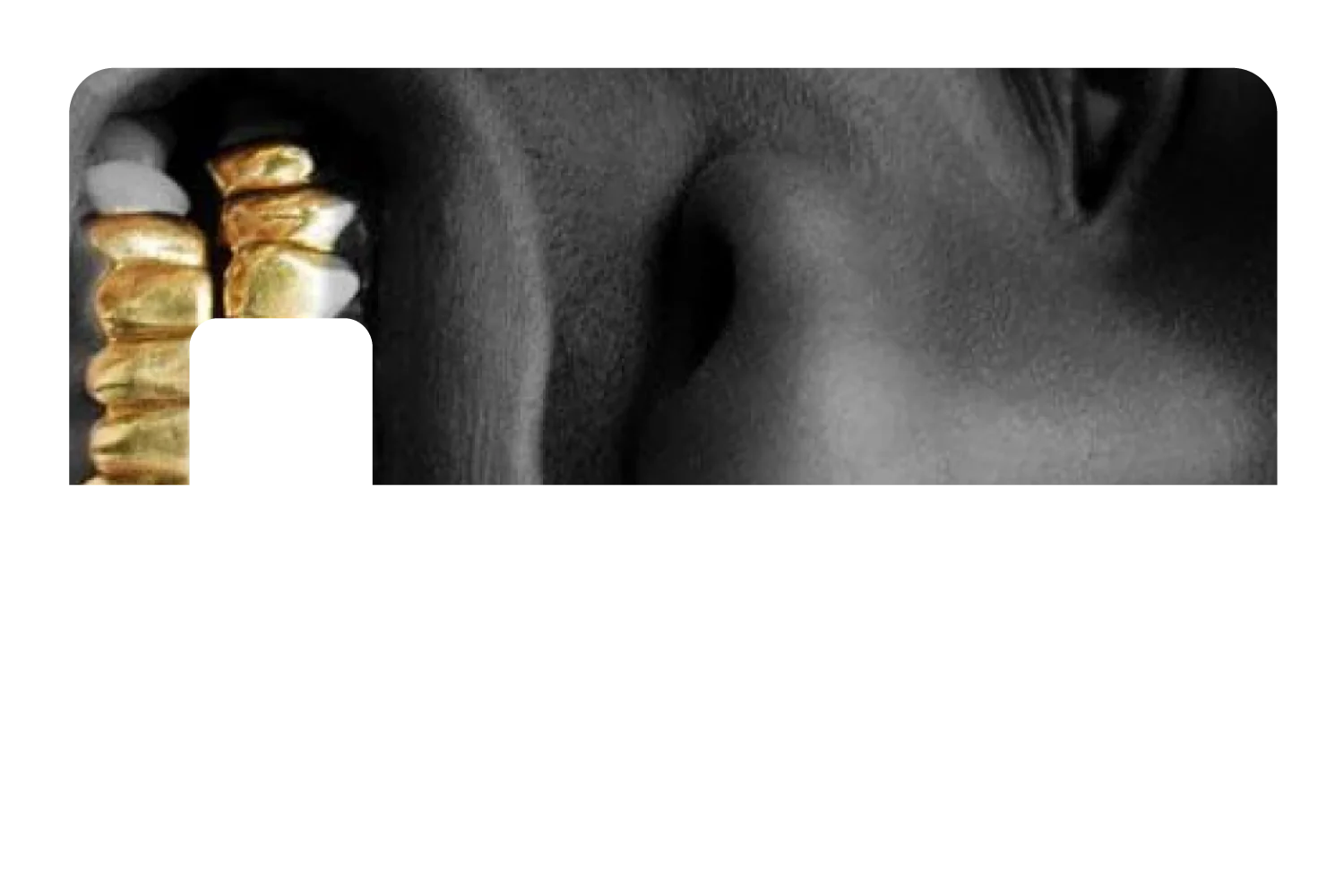 ASAP Grillz - Image 7
