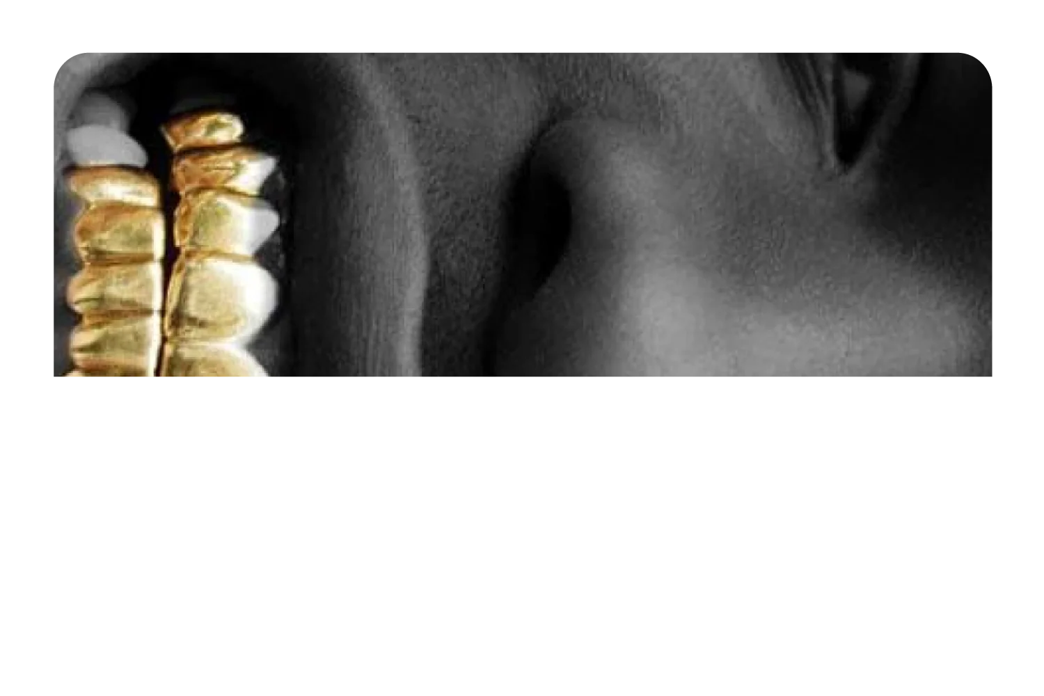 ASAP Grillz - Image 9