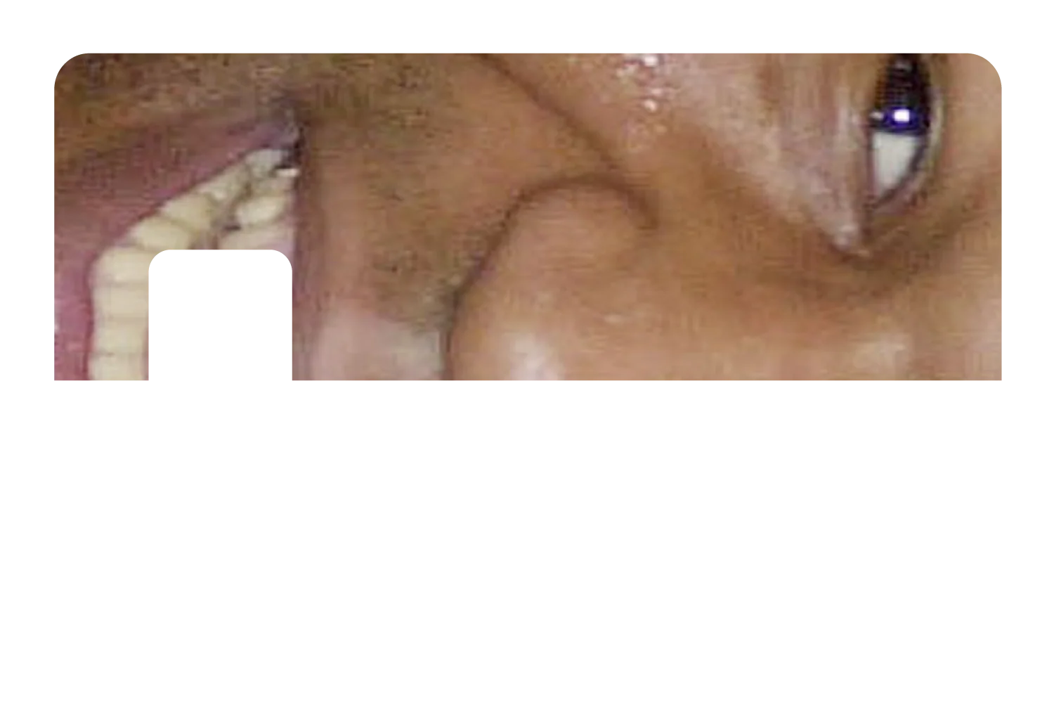 Tyson Grillz - Image 7